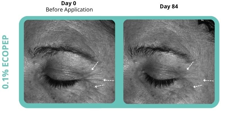 Clinical photos showing overall skin revitalisation and renewal with EcoPep 0.1% at Day 0 compared to Day 84, highlighting visible reduction in signs of ageing.