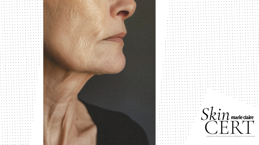 Inflammaging and The Skin: How Inflammation Drives Ageing