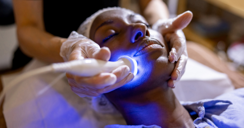 Best lasers for Black skin